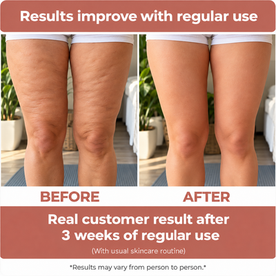 Skin texture illustration